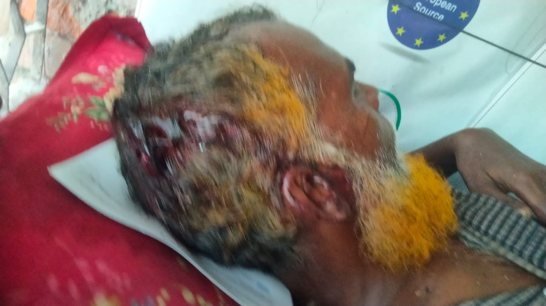 ফকিরহাটে দুপক্ষের সংঘর্ষে আহত-১, থানায় অভিযোগ দায়ের