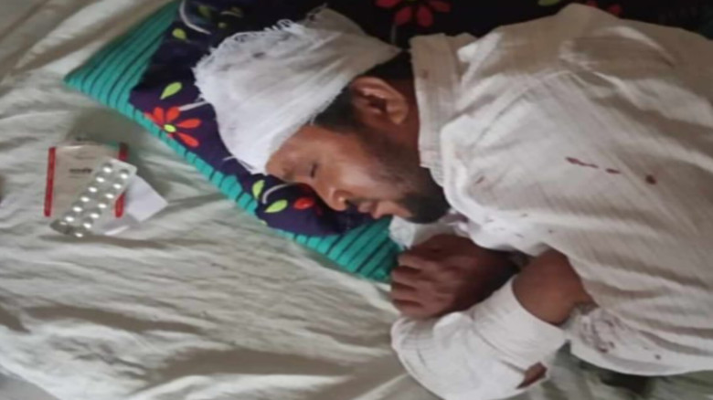 রমাগঞ্জ ০২নং ওয়ার্ড দুই পক্ষের সংঘর্ষে আহত -১, থানায় অভিযো
