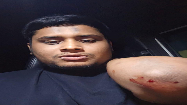 গাজীপুরে সন্ত্রাসী হামলার শিকার হাসনাত আব্দুল্লাহ: উত্তপ্ত র